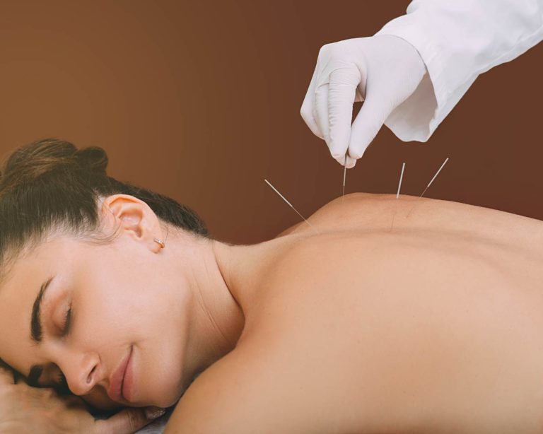 Veja quando tempo leva pra acupuntura fazer efeito